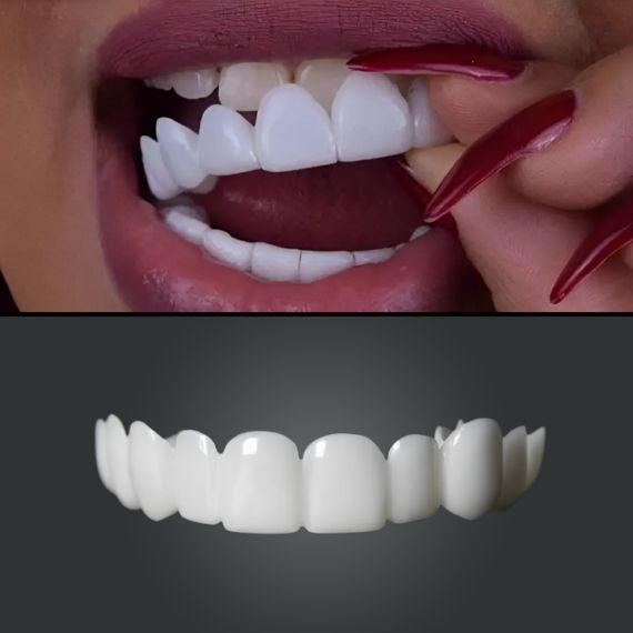 Carillas Instantánea Snap-on Smile