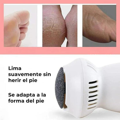 Removedor de callos SOFTMAX® Fácil y Recargable + Envío gratis